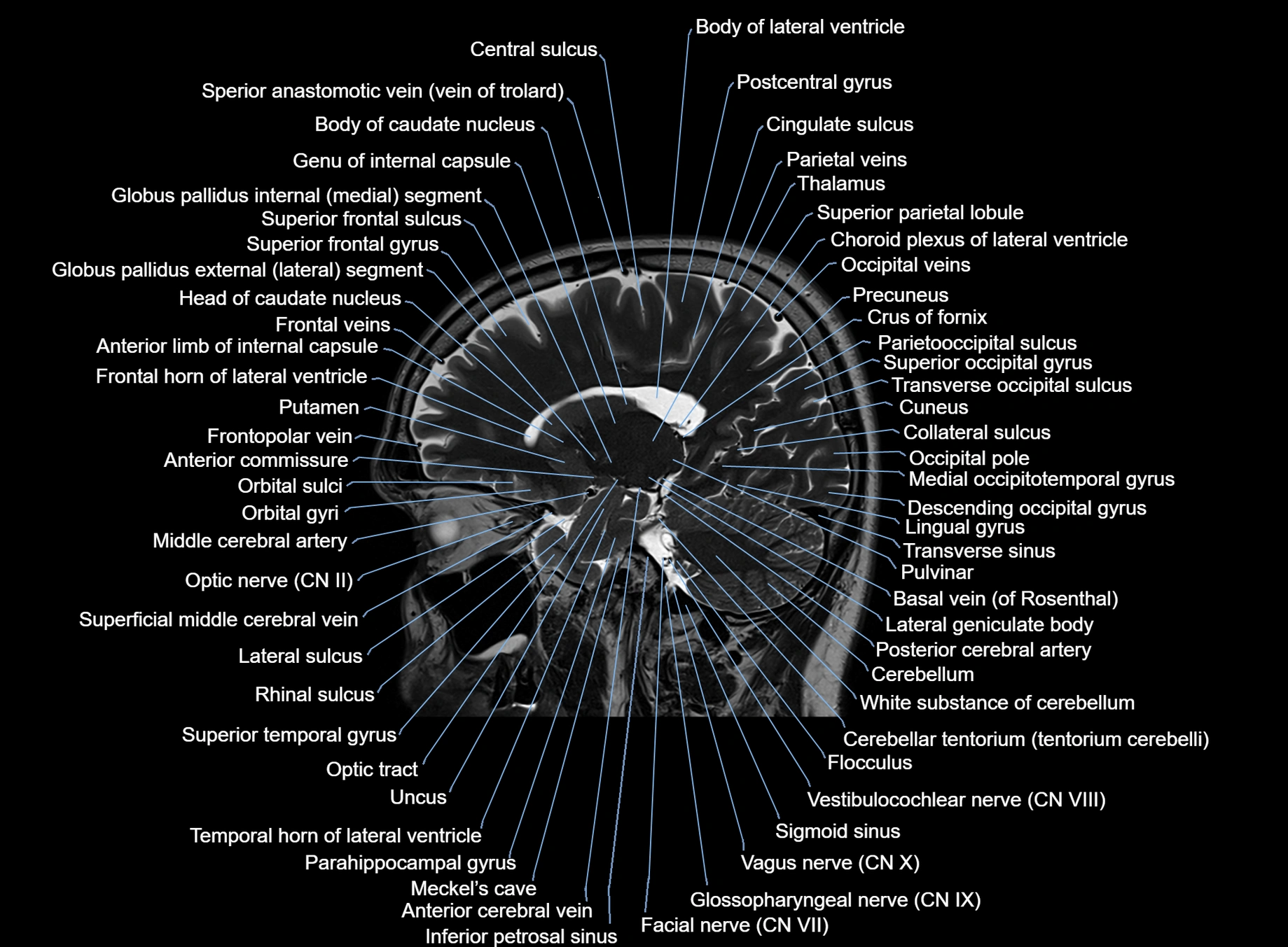 brain sagittal anatomy 3T MRI images -img-00001-00025.webp